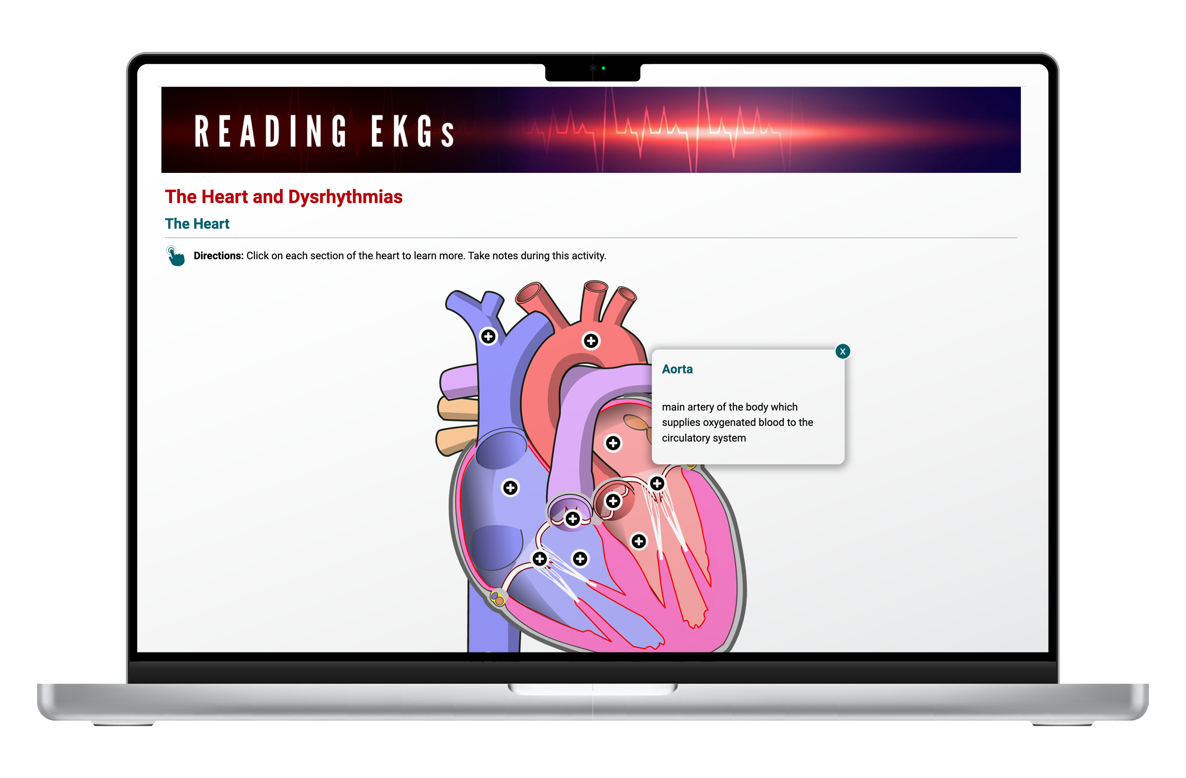 image of laptop showing heart and dysrhythmias content